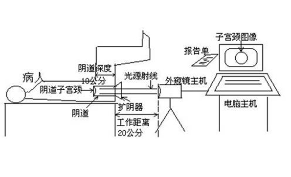 如何使用數碼電子陰道鏡?