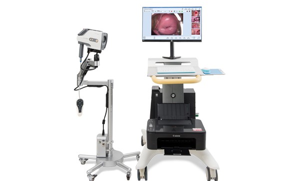 數(shù)碼電子陰道鏡與TCT技術診斷早期宮頸癌